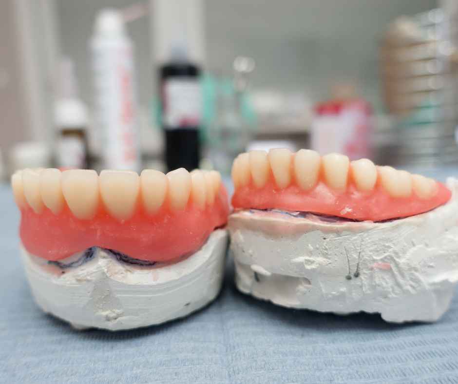 dentadura postiza