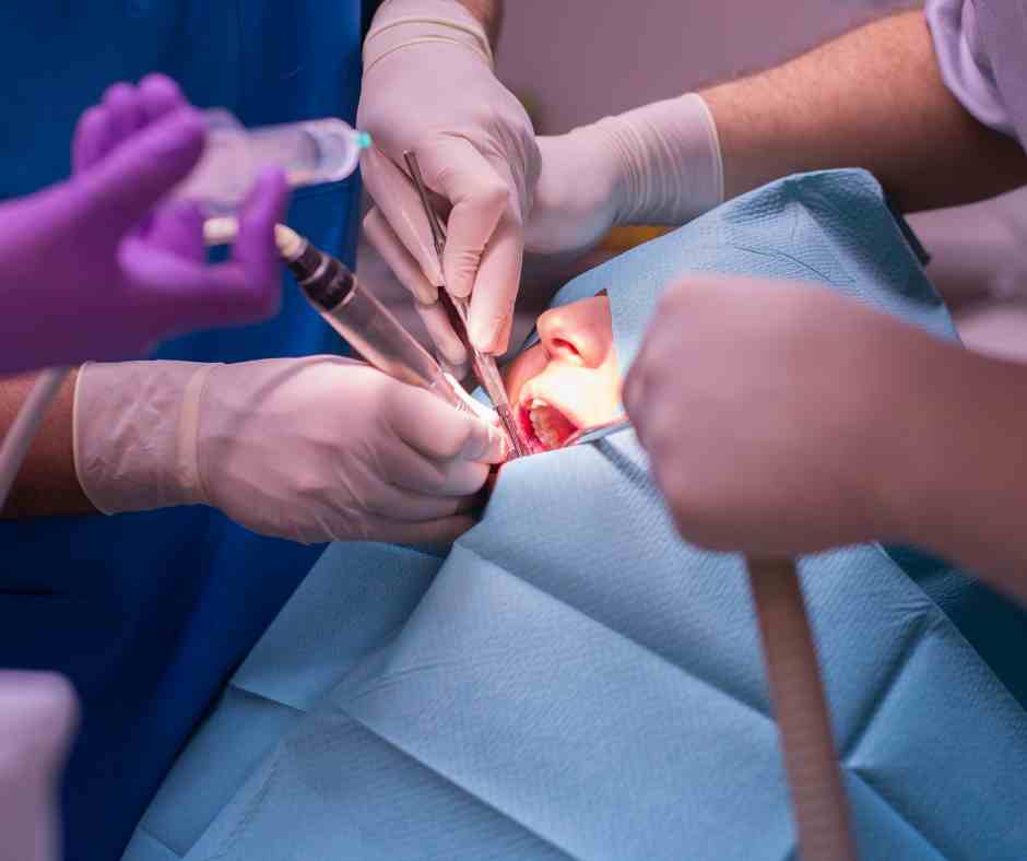 Extracción dental en el sur de Mérida en Dentaly