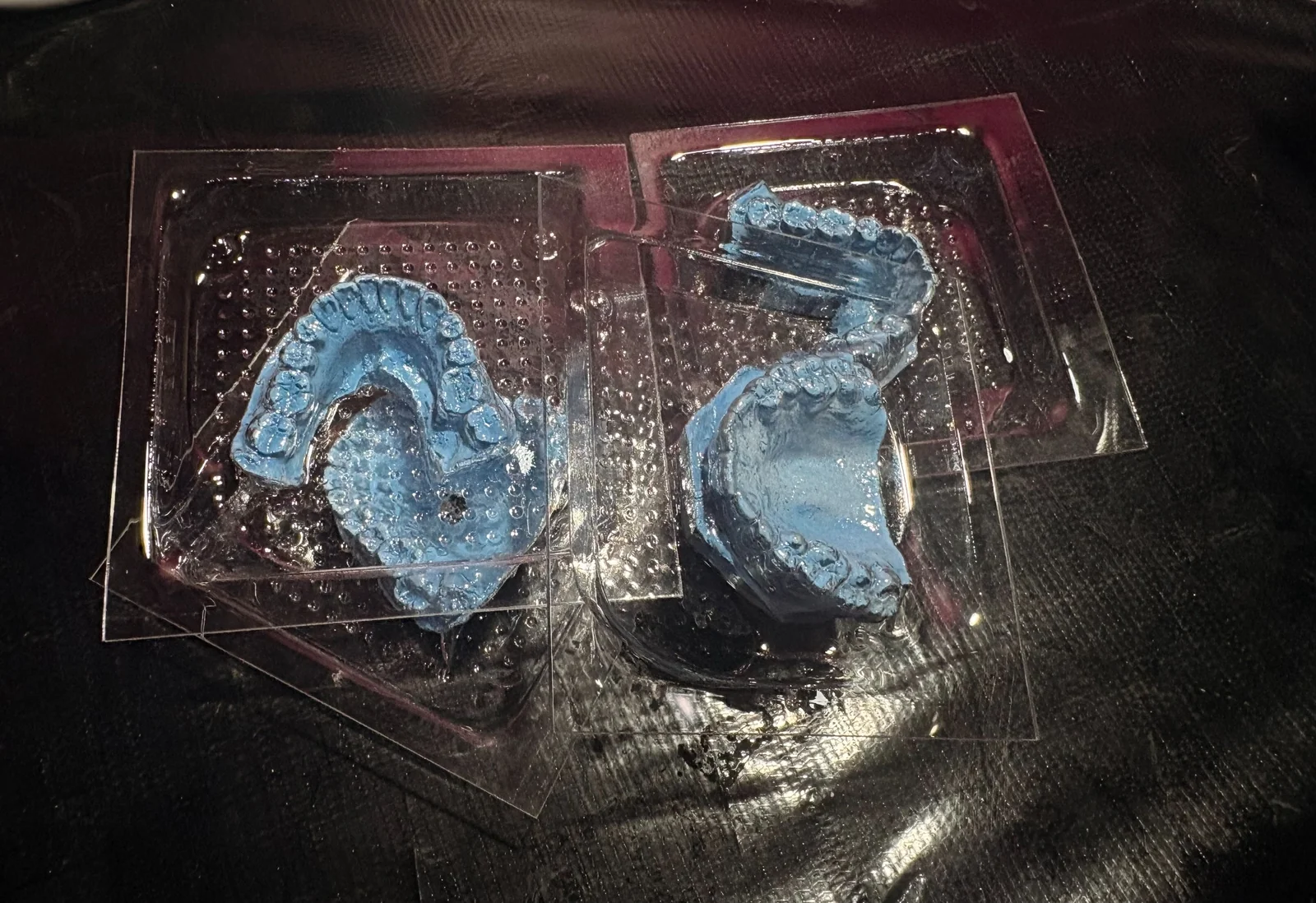 Modelos dentales para impresión de ortodoncia en Dentaly Mérida