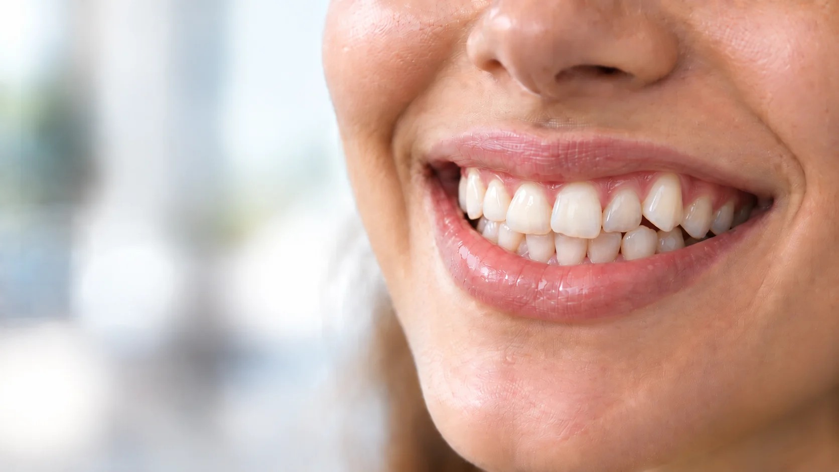 Sonrisa, valoración de ortodoncia en Mérida